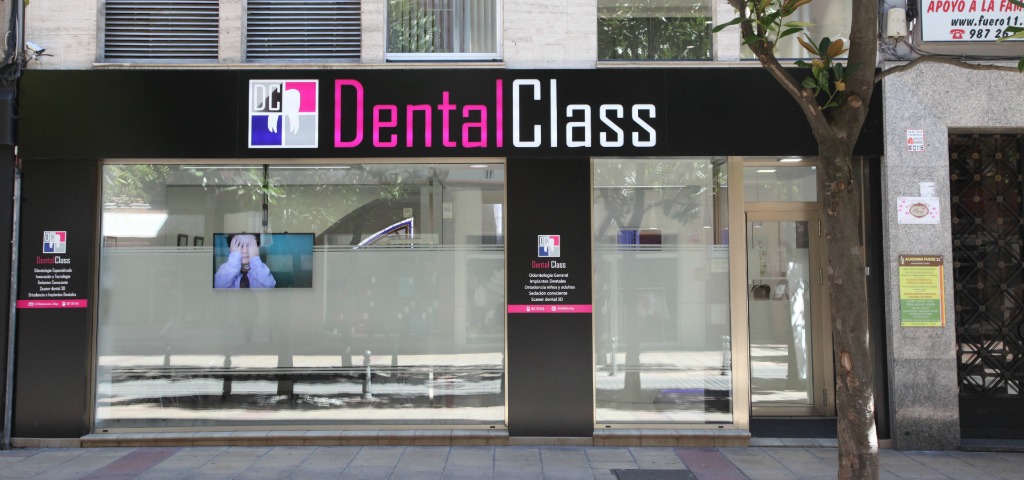 12 Preguntas más frecuentes sobre la Clínica Dental Class en León
