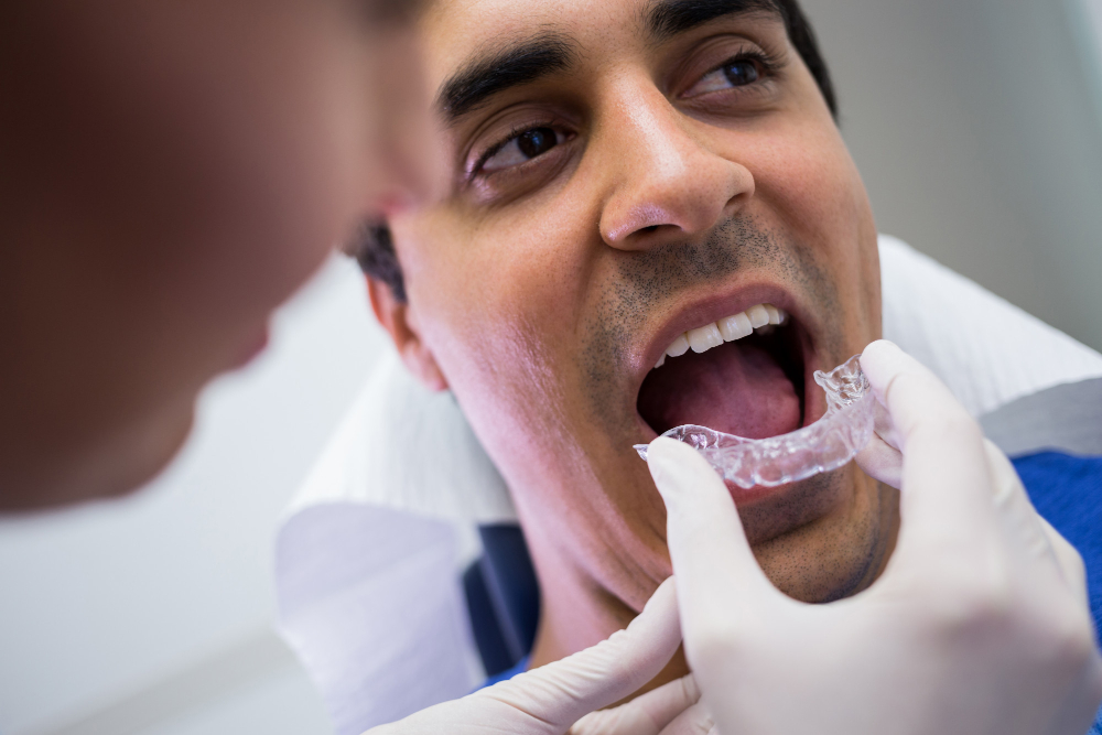 Ortodoncia invisible 1 blog periodoncia para gingivitis