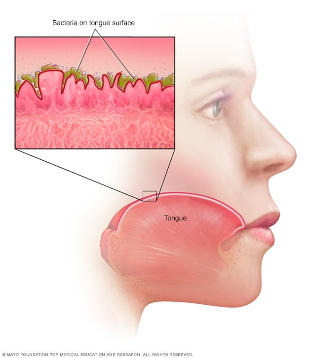 Ventajas del uso del láser dental 