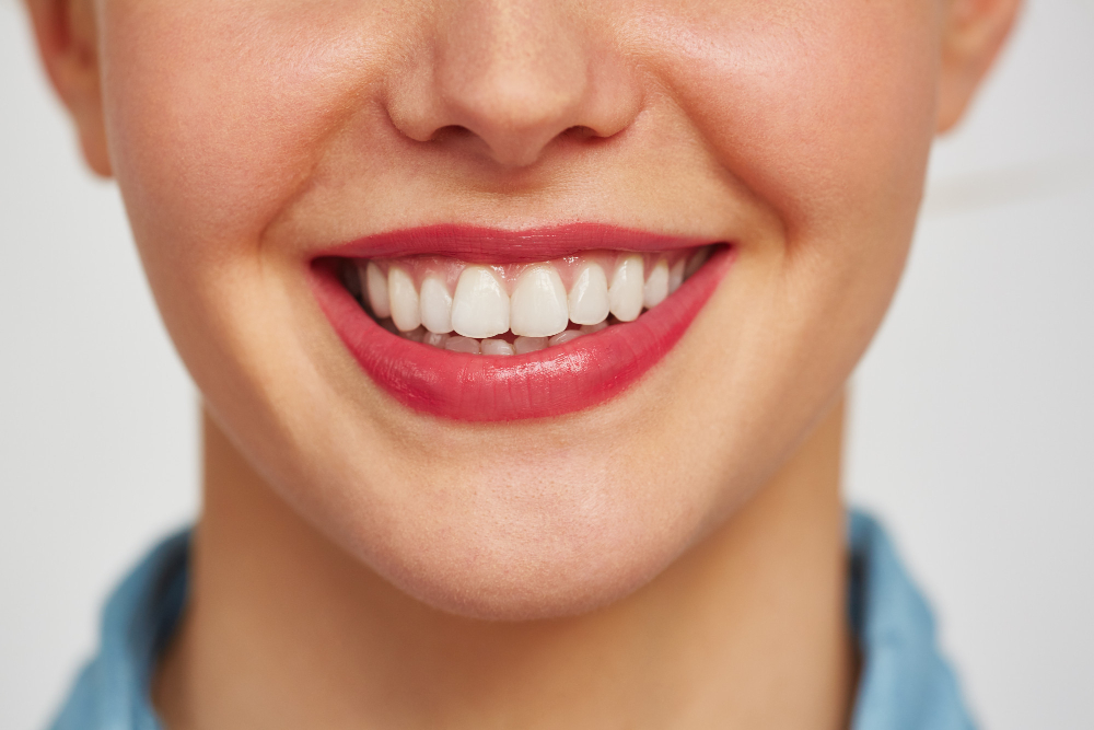 Guía completa sobre el blanqueamiento dental con Dental Class