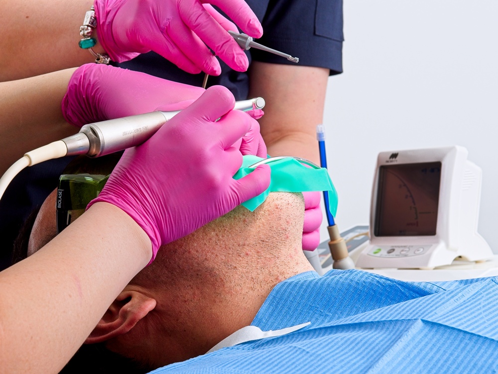 Clínica Dental en León España (1) periodoncia